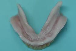 テイシュコンディショナーが義歯の内面に入っています。
