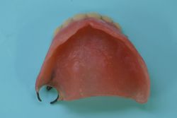 旧義歯　（上顎）