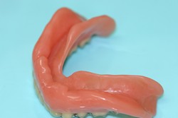 新義歯（下顎内側）