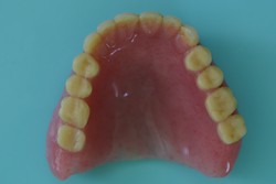 旧義歯　（上顎）