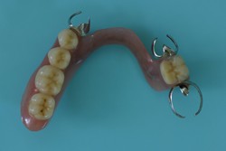 旧義歯　（下顎）