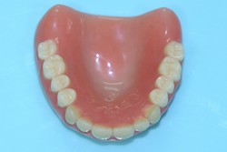 新義歯　（上顎）