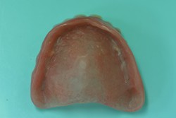 旧義歯（上顎　内側）